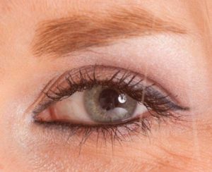 asian eyelid surgery northern virginia