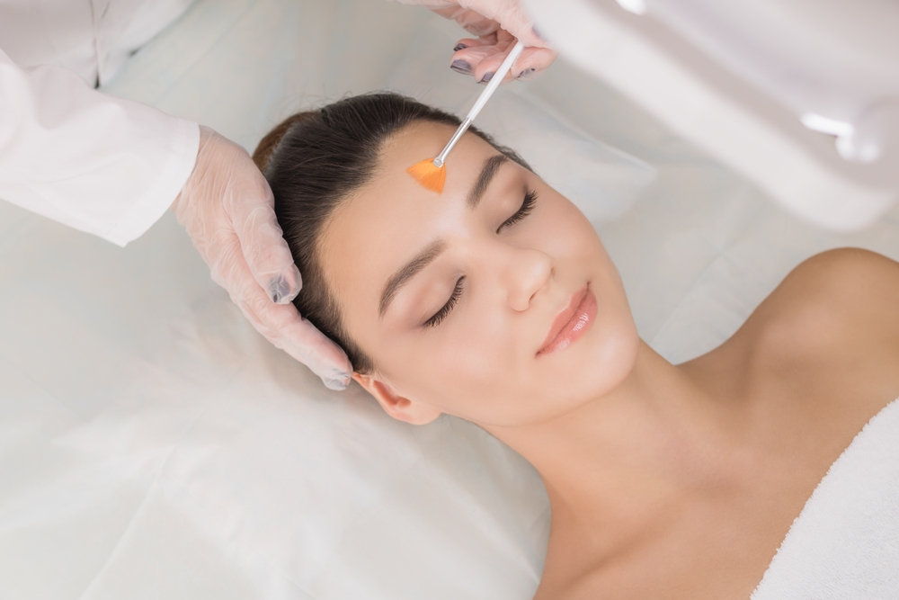 Can Chemical Peels Near Fairfax Treat Acne?