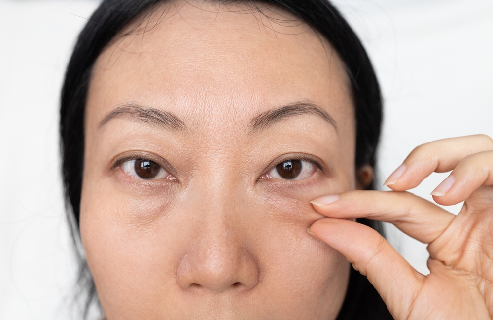 Read This if You Want Top Eyelid Surgery Doctor Near McLean, VA