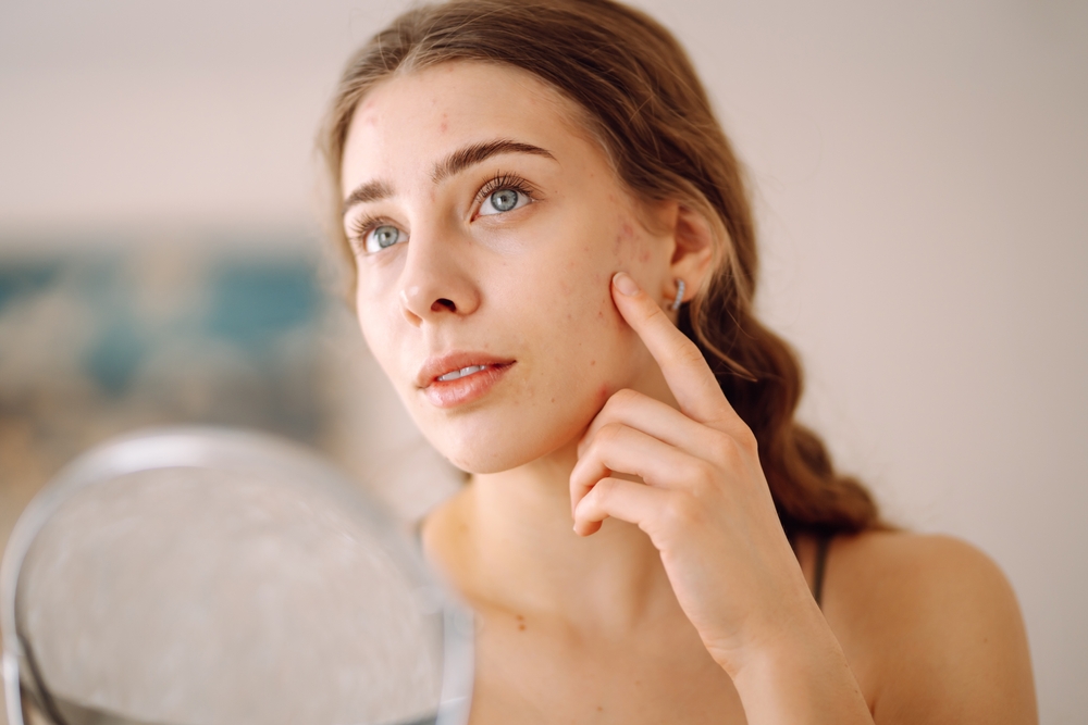 FAQs and Answers With an Acne Specialist in Fairfax