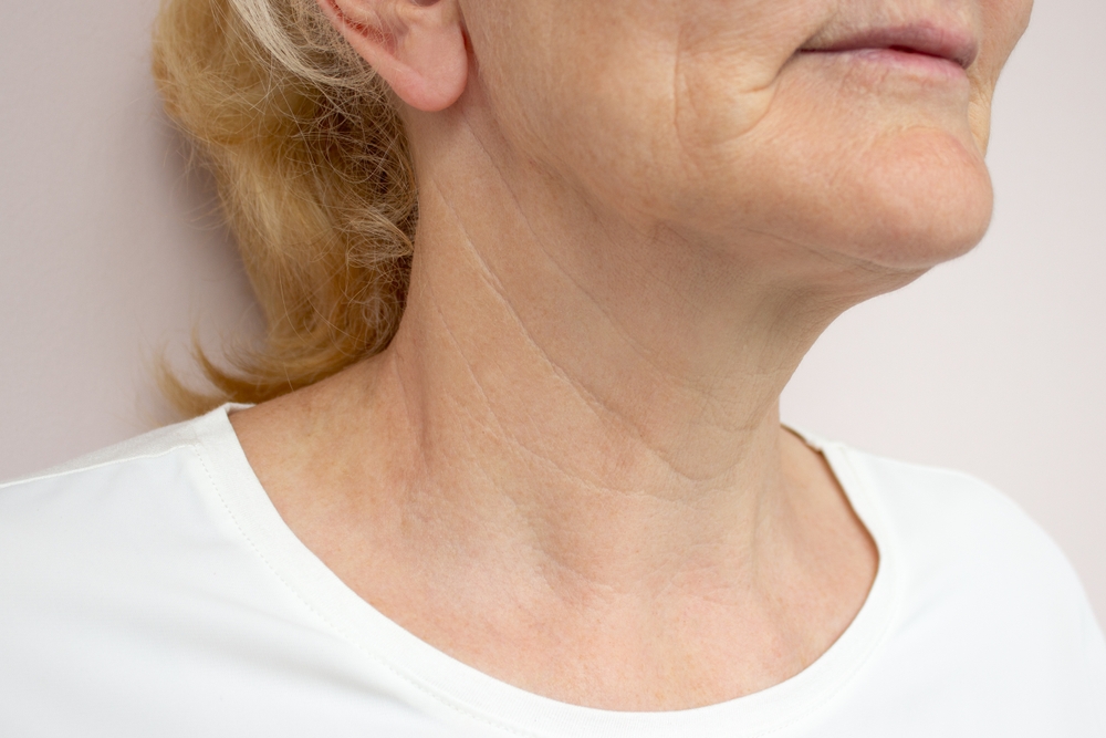 How Much Does Neck Lift Surgery Cost in Chantilly, Virginia?