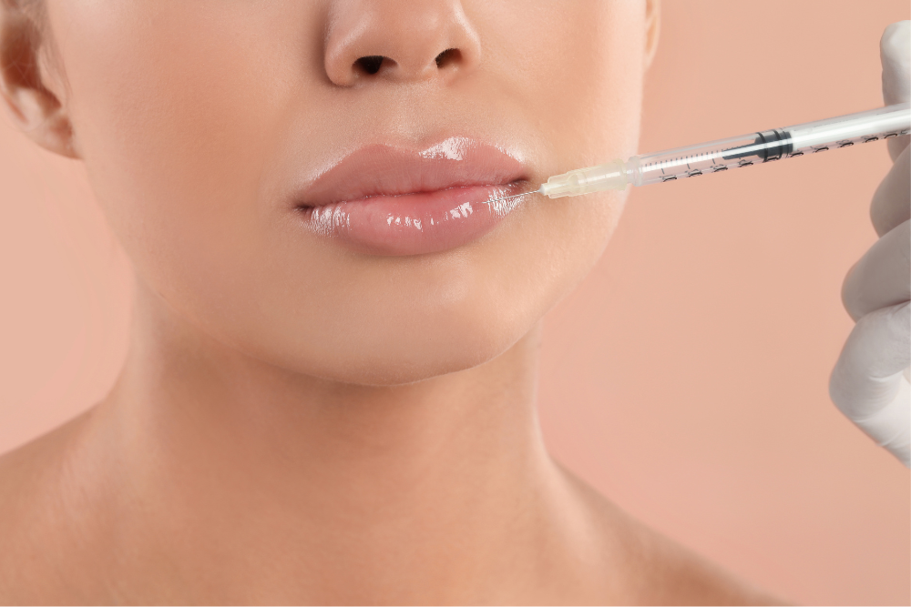 Longer Lasting Lip Filler in Fairfax