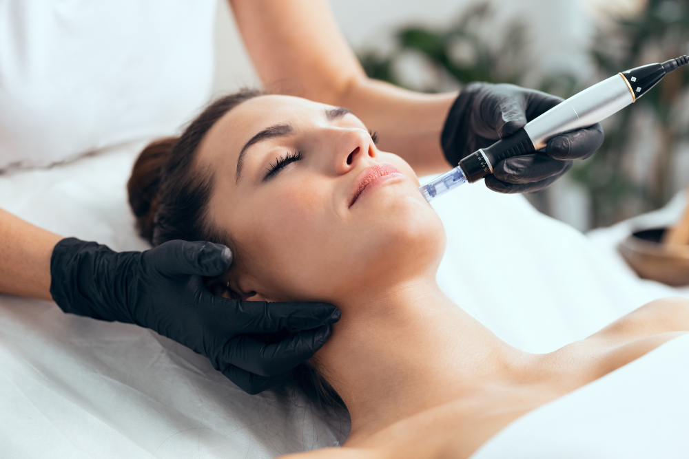 Microneedling Specialist in Fairfax