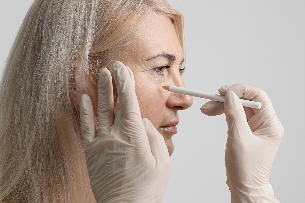 Blepharoplasty Cost in Herndon